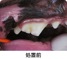 軽度歯周病処置前イメージ
