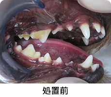 軽度歯周病処置前イメージ