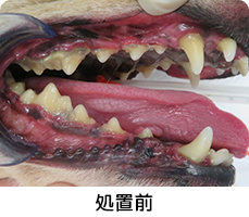 中程度歯周病処置前イメージ