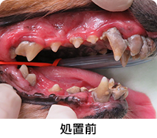 重度歯周病１処置前イメージ