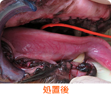 重度歯周病３処置後イメージ