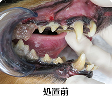 重度歯周病３処置前イメージ